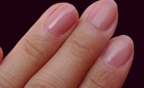 流言揭秘：指甲竖线不代表健康而是年轮？